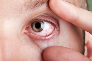 Os olhos revelam a saúde e a personalidade
