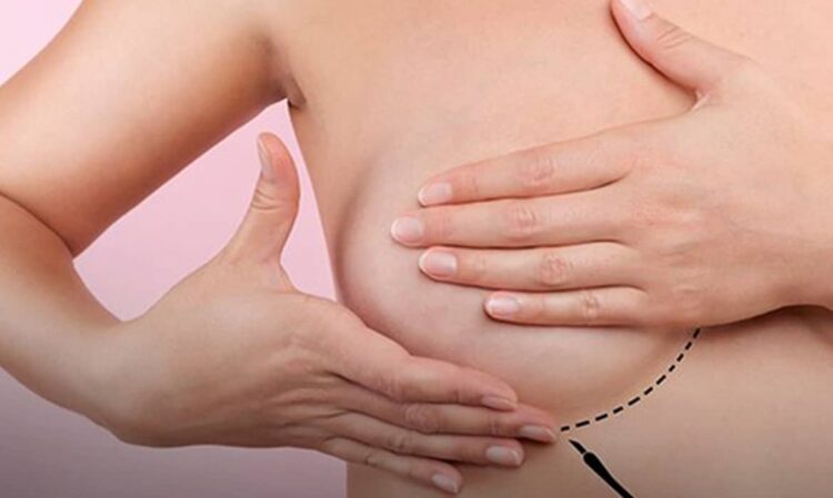 Câncer de mama pode regredir seis vezes mais rápido com tratamento