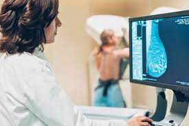 Mamografia: Femama orienta aguardar o prazo mínimo de um mês para realização do exame após a vacina da covid-19