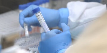 Paraná registra 481 casos e 28 óbitos por H3N2