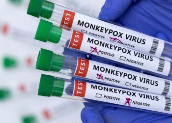 Saúde confirma em Maringá, segundo caso de varíola dos macacos
