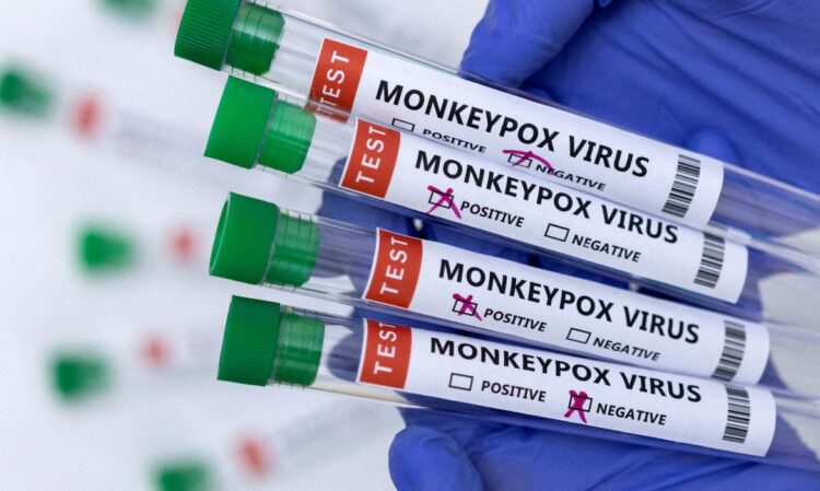 Saúde confirma em Maringá, segundo caso de varíola dos macacos