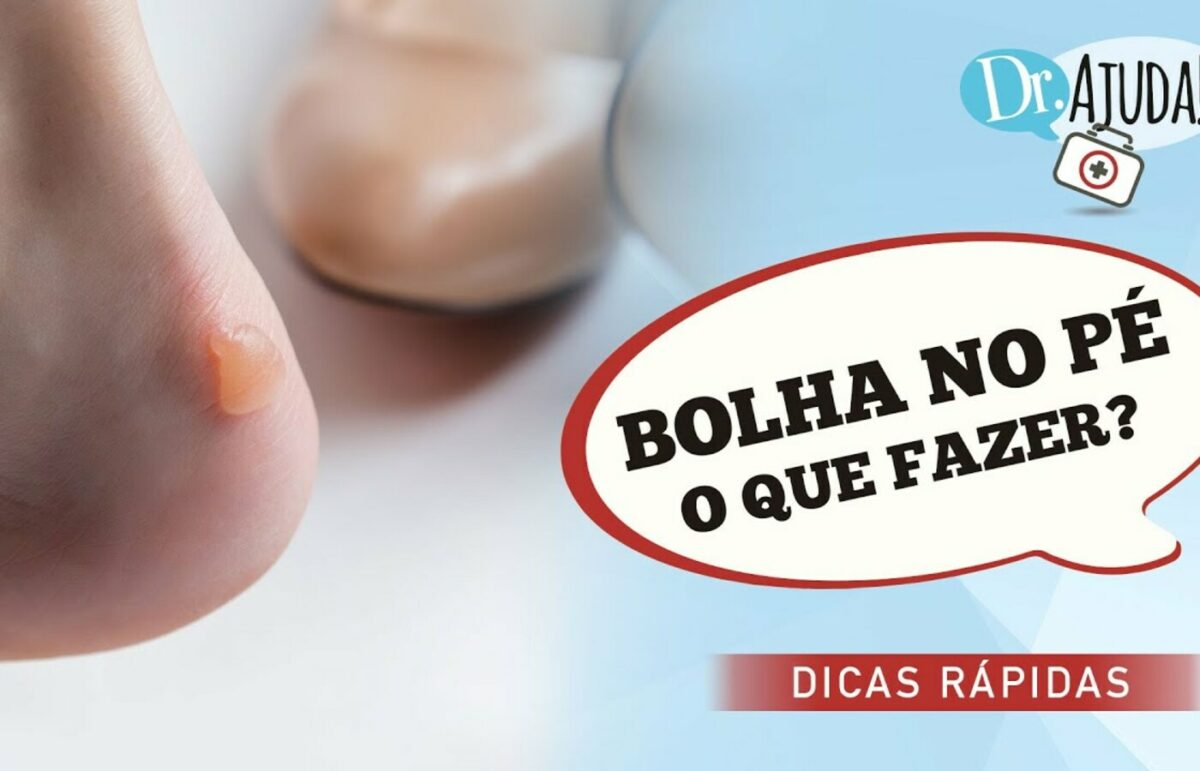 Bolha nos pés: o que devemos fazer quando elas aparecem?