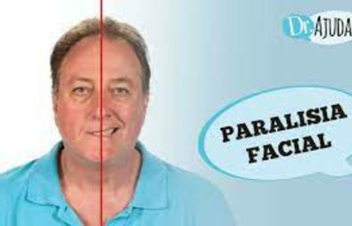 Paralisia facial: causas e tratamento