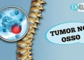 Tumor nos ossos: sintomas e diagnósticos