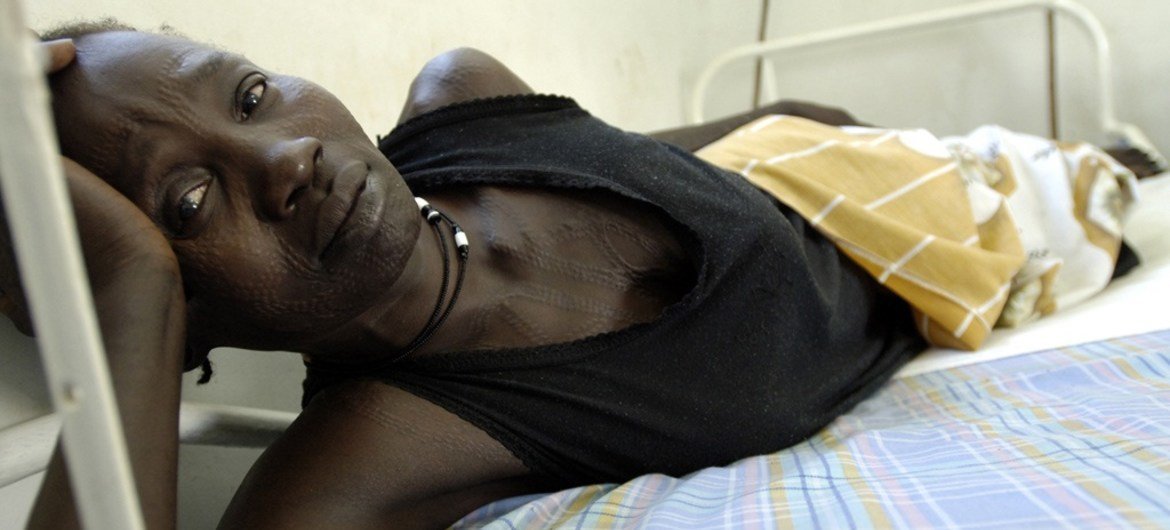 Uma paciente com fístula está deitada em uma cama de hospital em Juba, Sudão. A fístula obstétrica é um orifício no canal de parto, que ocorre como resultado de trabalho de parto prolongado ou obstruído sem intervenção médica.