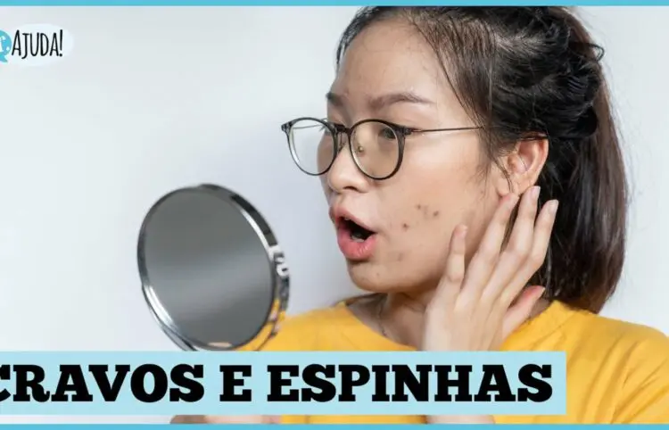 Cravos e espinhas: O que fazer? Quais as diferenças?
