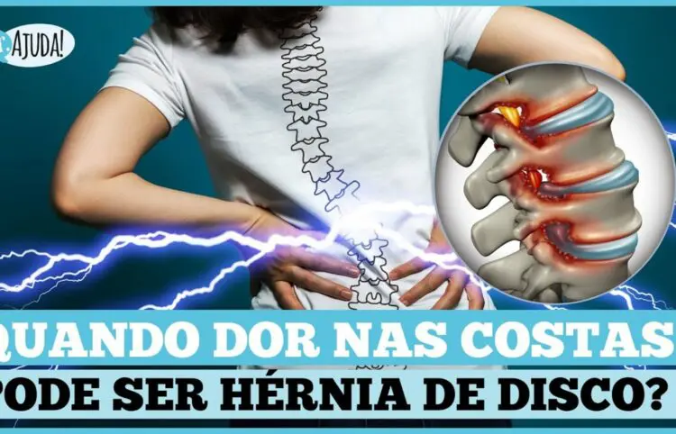 Hérnia de disco: Quando suspeitar? Qual o diagnóstico e o tratamento?