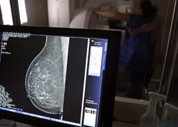 Mamografia agora é recomendada pelo Ministério da Saúde a partir dos 40 anos