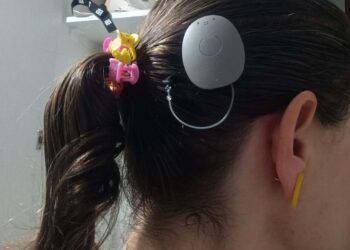 Paraná assume liderança em implante coclear pelo SUS