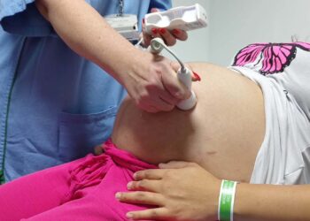 Ultrassom morfológico passa a ser ofertado a 100% das gestantes atendidas no Paraná