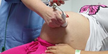 Ultrassom morfológico passa a ser ofertado a 100% das gestantes atendidas no Paraná