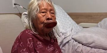 Cacique Raoni, com câncer, recebe cuidados paliativos em casa