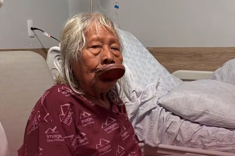 Cacique Raoni, com câncer, recebe cuidados paliativos em casa